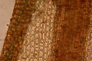 Ceratodon cells