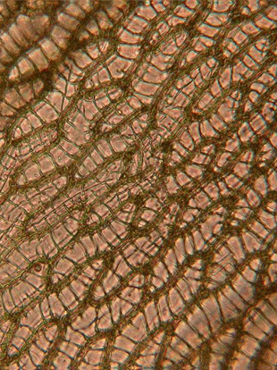 Sphagnum cells